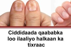 Ciddida qaababka loo ilaaliyo halkaan ka tixraac