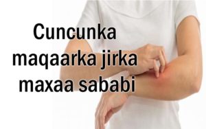 Cuncunka maqaarka jirka maxaa sababi kara