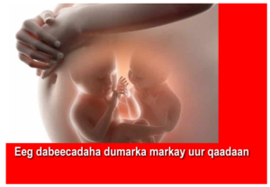 Eeg dabeecadaha dumarka markay uur qaadaan