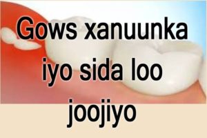 Gows xanuunka iyo sida loo joojiyo