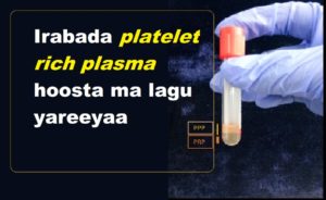 Irabada platelet rich plasma hoosta ma lagu yareeyaa