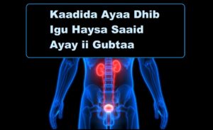 Kaadida Ayaa Dhib Igu Haysa Saaid Ayay ii Gubtaa