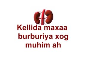 Kellida maxaa burburiya xog muhim ah