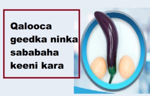 Qalooca geedka ninka sababaha keeni kara