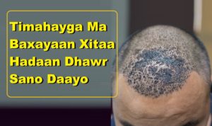 Timahayga Ma Baxayaan Xitaa Hadaan Dhawr Sano Daayo