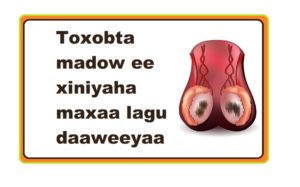 Toxobta madow ee xiniyaha maxaa lagu daaweeyaa