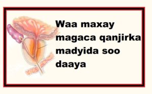 Waa maxay magaca qanjirka madyida soo daaya