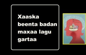 Xaaska beenta badan maxaa lagu gartaa