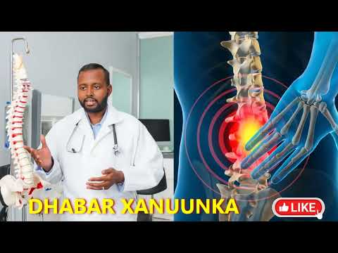Dhabar xanuunka sababaha keena iyo cudurada uu tilmaamo iyo qaabka loo daaweeyo