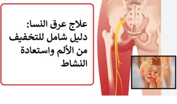 علاج عرق النسا: دليل شامل للتخفيف من الألم واستعادة النشاط