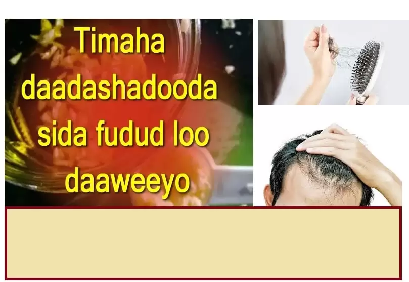 Timaha daadashadooda sida fudud loo daaweeyo