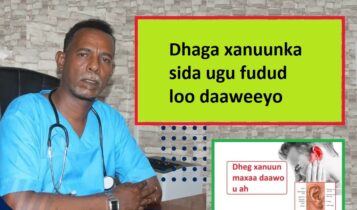 Dhaga xanuunka sida ugu fudud loo daaweeyo Dhaga xanuunka sida ugu fudud loo daaweeyo