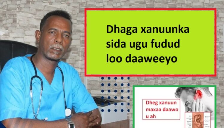 Dhaga xanuunka sida ugu fudud loo daaweeyo