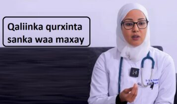 Qaliinka qurxinta sanka waa maxay Qaliinka qurxinta sanka waa maxay