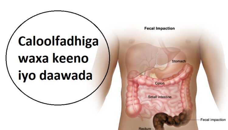 Caloolfadhiga waxa keeno iyo daawada