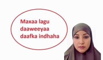 Maxaa lagu daaweeyaa daafka indhaha Maxaa lagu daaweeyaa daafka indhaha