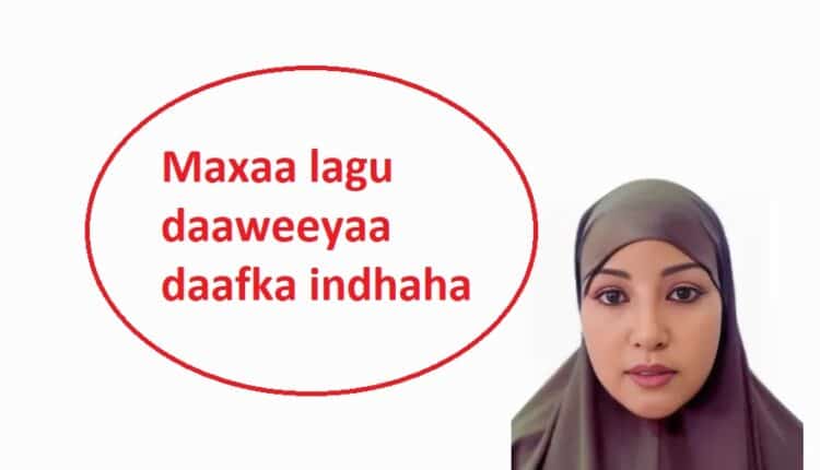 Maxaa lagu daaweeyaa daafka indhaha