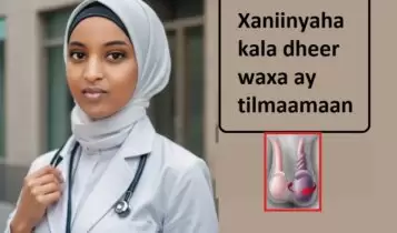 Xaniinyaha kala dheer waxa ay tilmaamaan Xaniinyaha kala dheer waxa ay tilmaamaan