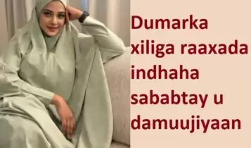 Dumarka xiliga raaxada indhaha sababtay u damuujiyaan Dumarka xiliga raaxada indhaha sababtay u damuujiyaan