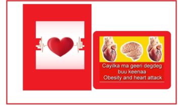 Cayilka ma geeri degdeg buu keenaa Obesity and heart attack