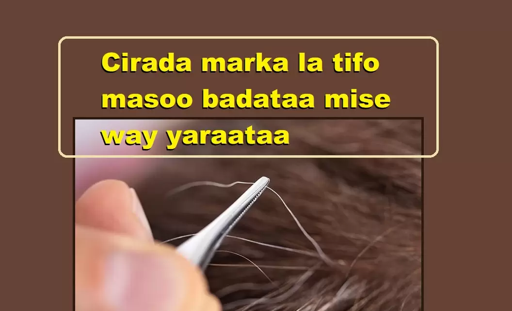 Cirada marka la tifo masoo badataa mise way yaraataa