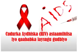 Cudurka Aydhiska (HIV) astaamihiisa iyo qaababka laysugu gudbiyo Cudurka Aydhiska (HIV) astaamihiisa iyo qaababka laysugu gudbiyo