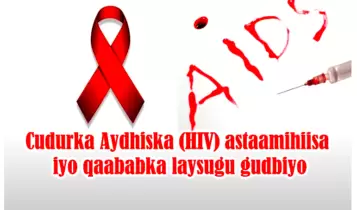 Cudurka Aydhiska (HIV) astaamihiisa iyo qaababka laysugu gudbiyo Cudurka Aydhiska (HIV) astaamihiisa iyo qaababka laysugu gudbiyo