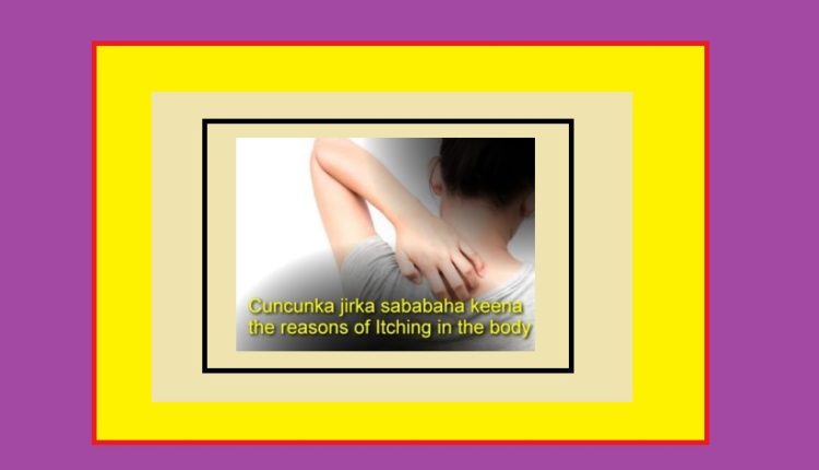 Cuncunka jirka sababaha keena the reasons of Itching in the body 1