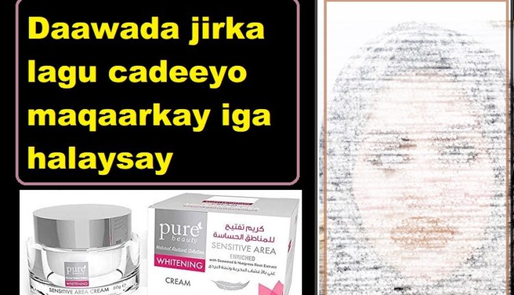 Daawada jirka lagu cadeeyo maqaarkay iga halaysay