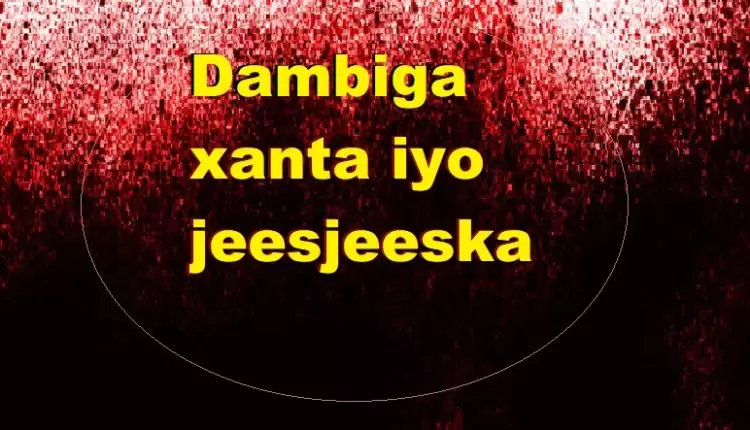 Dambiga xanta iyo jeesjeeska