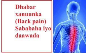 Dhabar xanuunka (Back pain) Sababaha iyo daawada