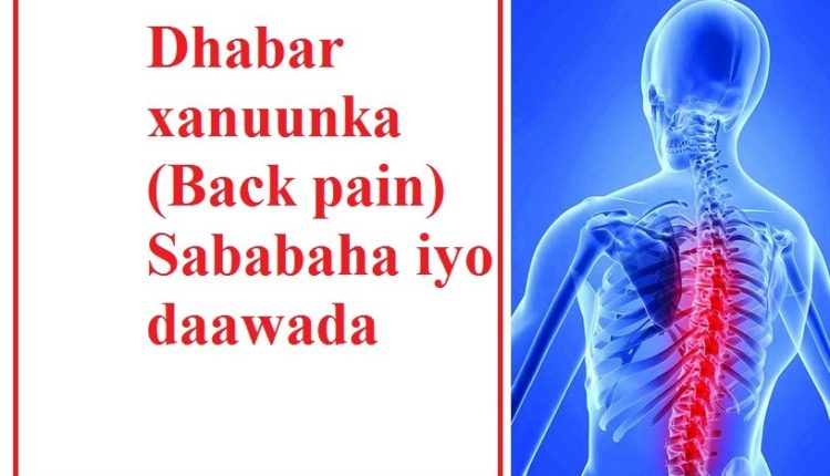 Dhabar xanuunka (Back pain) Sababaha iyo daawada