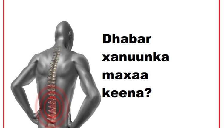 Dhabar xanuunka maxaa keena