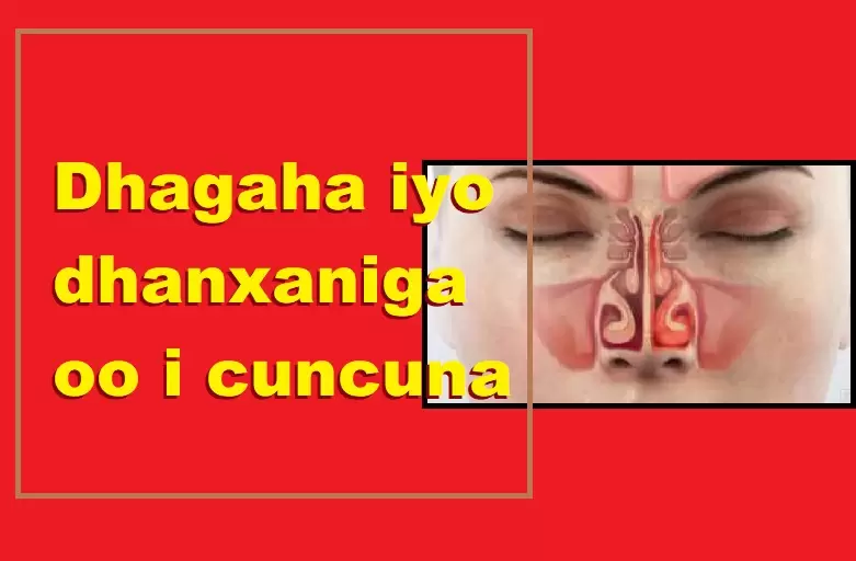 Dhagaha iyo dhanxaniga oo i cuncuna