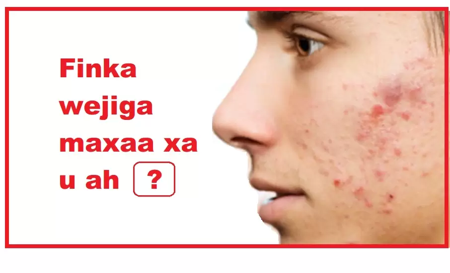 Finka wejiga maxaa xa u ah