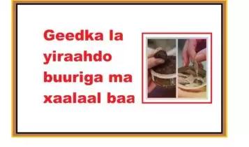 Geedka la yiraahdo buuriga ma xaalaal baa Geedka la yiraahdo buuriga ma xaalaal baa
