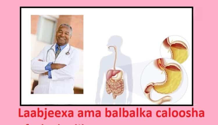 Laabjeexa ama balbalka caloosha afurka kadib