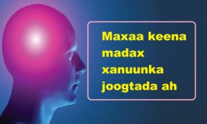 Maxaa keena madax xanuunka joogtada ah