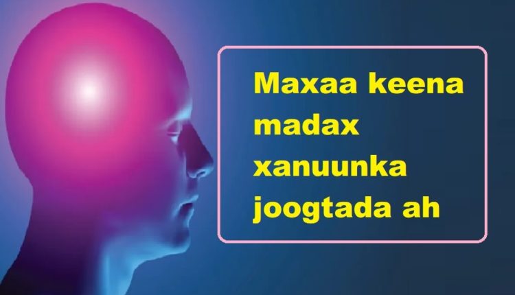 Maxaa keena madax xanuunka joogtada ah