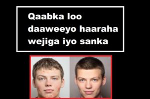 Qaabka loo daaweeyo haaraha wejiga iyo sanka