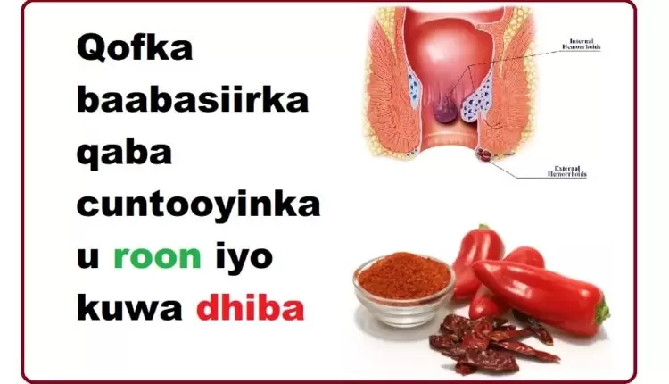 Qofka baabasiirka qaba cuntooyinka u roon iyo kuwa dhiba