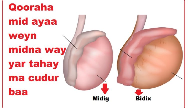 Qooraha mid ayaa weyn midna way yar tahay ma cudur baa