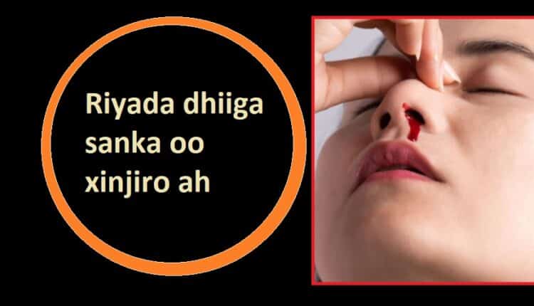 Riyada dhiiga sanka oo xinjiro ah