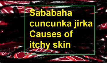 Sababaha cuncunka jirka Causes of itchy skin