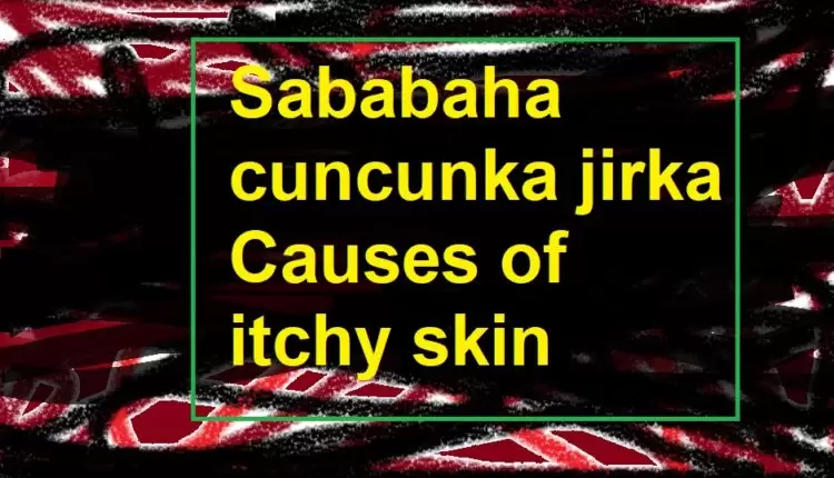 Sababaha cuncunka jirka Causes of itchy skin1