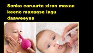 Sanka caruurta xiran maxaa keeno maxaase lagu daaweeyaa