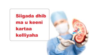 Siigada dhib ma u keeni kartaa kelliyaha