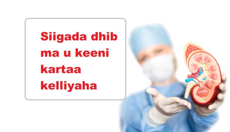 Siigada dhib ma u keeni kartaa kelliyaha