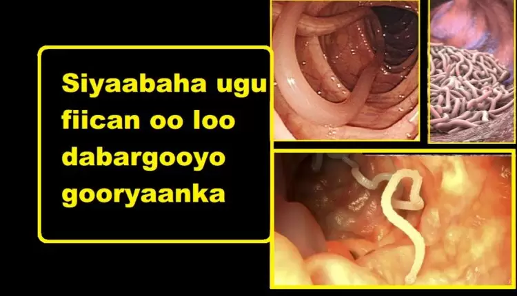 Siyaabaha ugu fiican oo loo dabargooyo gooryaanka