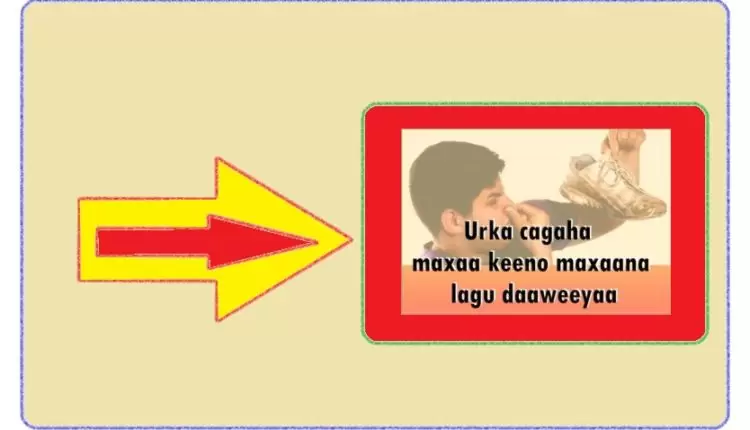 Urka cagaha maxaa keeno maxaana lagu daaweeyaa 1